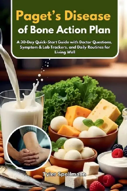 Paget's Disease of Bone Action Plan: A 30-Day Quick-Start Guide with Doctor Questions, Symptom & Lab Trackers, and Daily Routines for Living Well by Tyler Spellmann