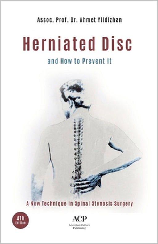 Lumbar Disc Herniation by Ahmet Yildizhan