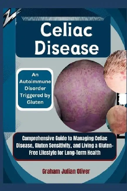 Celiac Disease: An Autoimmune Disorder Triggered by Gluten: Comprehensive Guide to Managing Celiac Disease, Gluten Sensitivity, and Li by Graham Julian Oliver