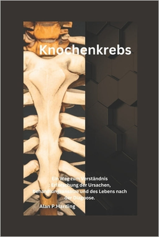 Knochenkrebs: Ein Weg zum Verständnis: Erforschung der Ursachen, Behandlungsansätze und des Lebens nach der Diagnose. by Alan P. Harding