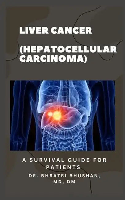 Liver Cancer (Hepatocellular Carcinoma): A survival guide for patients by Bhratri Bhushan