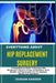 Everything about Hip Replacement Surgery: A Comprehensive Guide To Recovery, Pain Management, Physical Therapy, Rehabilitation, Risks, Benefits, And P by Dorian Karren