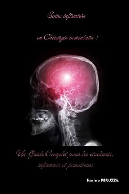 Soins infirmiers en Chirurgie vasculaire: Un Guide Complet pour les étudiants, infirmiers et formateurs by Karine Peruzza