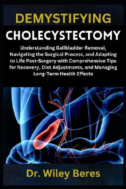 Demystifying Cholecystectomy: Understanding Gallbladder Removal, Navigating the Surgical Process, and Adapting to Life Post-Surgery with Comprehensive by Wiley Beres