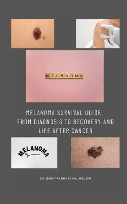Melanoma Survival Guide: From Diagnosis to Recovery and Life After Cancer by Bhratri Bhushan