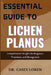 Essential Guide To Lichen Planus: Comprehensive Insights For Diagnosis Treatment And Mana  by Loren Casey