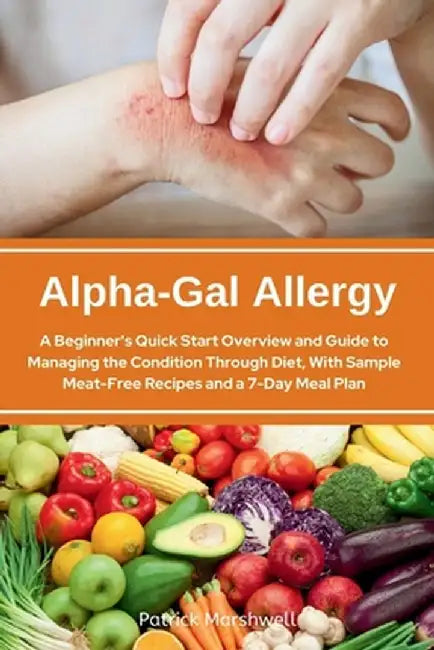 Alpha-Gal Allergy: A Beginner's Quick Start Overview and Guide to Managing the Condition Through Diet, with Sample Meat-Free Recipes and by Patrick Marshwell
