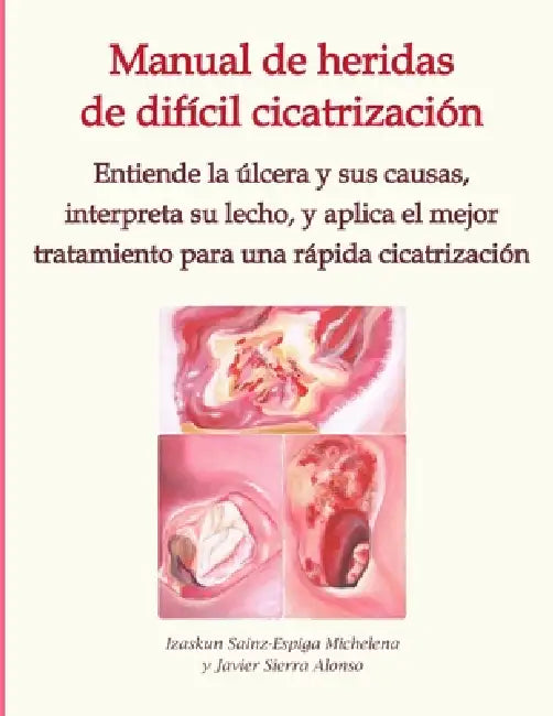 Manual de heridas de difícil cicatrización: Entiende la úlcera y sus causas, interpreta su lecho, y aplica el mejor tratamiento para una rápida cicatr by Javier Sierra Alonso, Izaskun Sainz-Espiga Michelena
