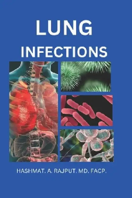 Lung Infections by Hashmat A. Rajput