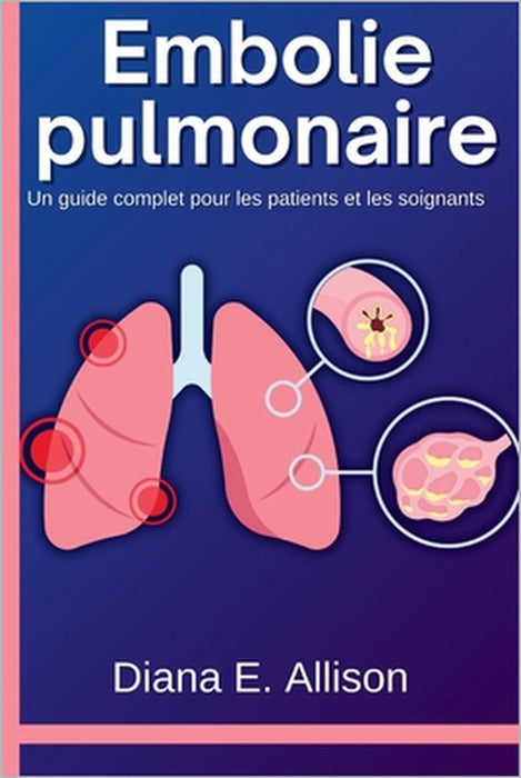 Embolie pulmonaire: Un guide complet pour les patients et les soignants: Votre chemin vers la compréhension, le traitement et la guérison durable by Diana E. Allison