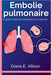 Embolie pulmonaire: Un guide complet pour les patients et les soignants: Votre chemin vers la compréhension, le traitement et la guérison durable by Diana E. Allison