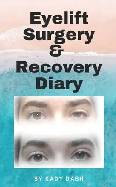 Eyelift Surgery and Recovery Diary: Ptosis, eyelifts, punctal plugs, and dry eyes by Kady Dash