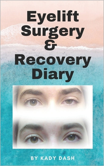 Eyelift Surgery and Recovery Diary: Ptosis, eyelifts, punctal plugs, and dry eyes by Kady Dash