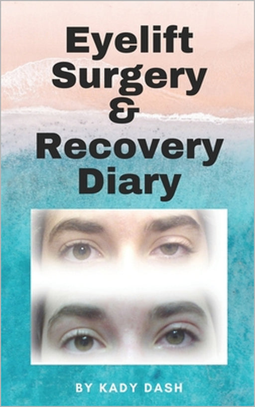 Eyelift Surgery and Recovery Diary: Ptosis, eyelifts, punctal plugs, and dry eyes by Kady Dash