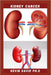 Kidney Cancer: Step By Step Guide On How To Heal Your Kidney And Live Healthily by Kevin David Ph. D.