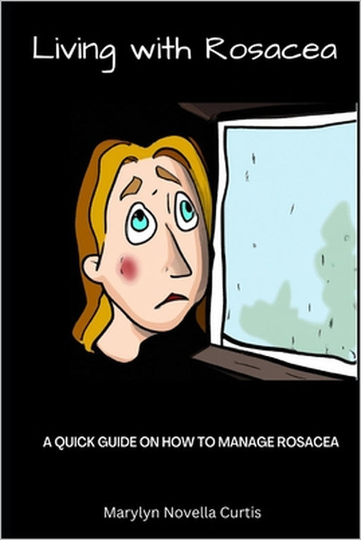 Living with Rosacea: A Quick Guide on How to Manage Rosacea by Marlyn Curtis