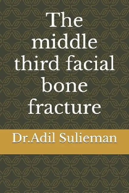 The middle third facial bone fracture by Adil Sulieman