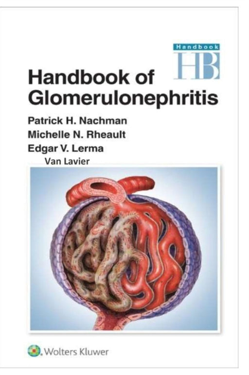 Handbook of Glomerulonephritis by Lavier, Van