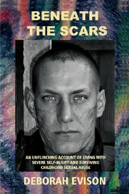 Beneath the Scars: An unflinching account of living with severe self-injury and surviving childhood sexual abuse by Deborah Evison