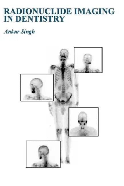 Radionuclide Imaging in Dentistry by Ankur Singh