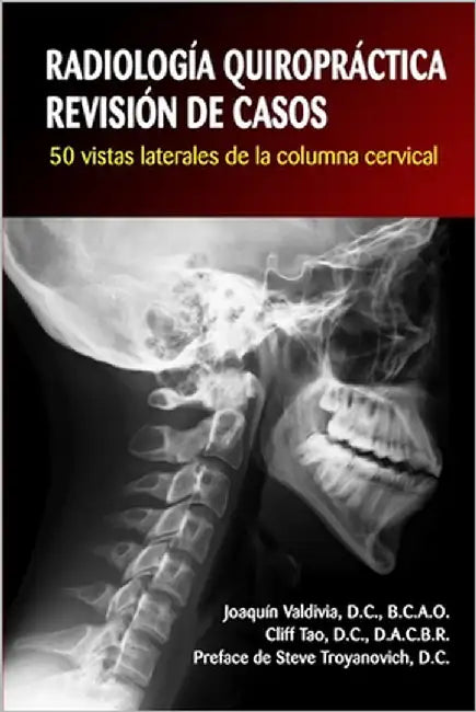 Radiología Quiropráctica: REVISIÓN DE CASOS. 50 vistas laterales de la columna cervical by Tao, Cliff