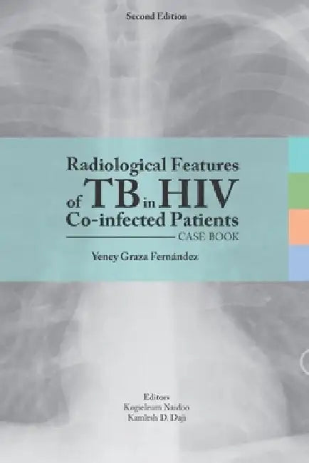 Radiological features of TB in HIV Co-infected Patients. Case book by Kogieleum Naidoo