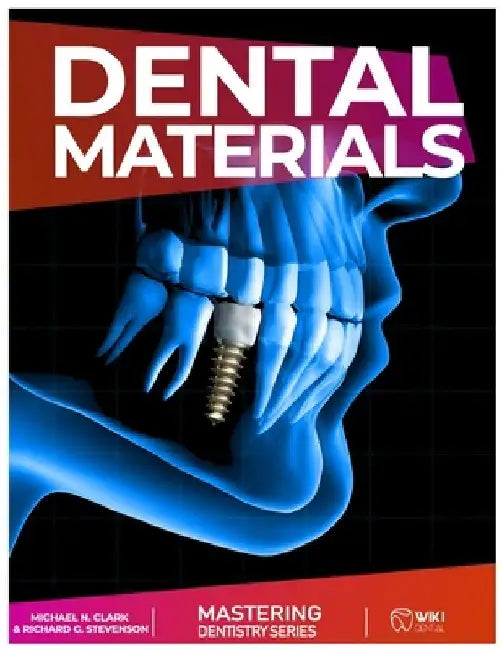 Mastering Dentistry Series: Dental Material: Handbook of Dental Materials by Richard G. Stevenson
