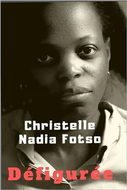 Défigurée by Fotso, Christelle Nadia