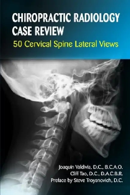 Chiropractic Radiology Case Review: 50 Cervical Spine Lateral Views by Cliff Tao
