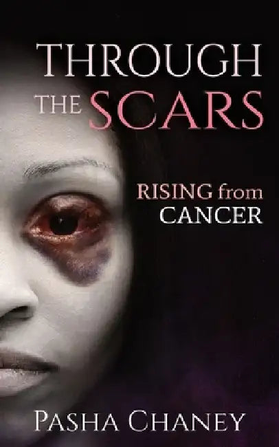 Through the Scars: Rising from Cancer by Pasha Chaney