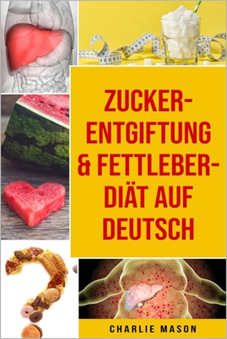 Zucker-Entgiftung & Fettleber-Diät Auf Deutsch by Charlie Mason