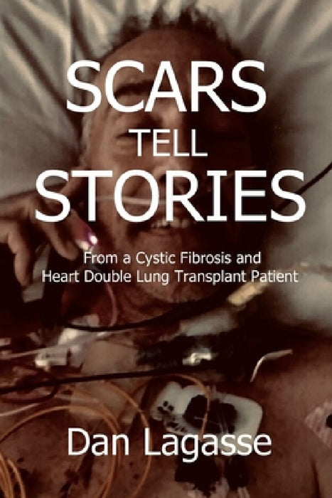 Scars Tell Stories: From a Cystic Fibrosis and Heart/Double Lung Transplant Patient by Doug Lagasse