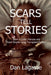 Scars Tell Stories: From a Cystic Fibrosis and Heart/Double Lung Transplant Patient by Doug Lagasse