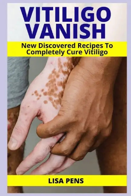 Vitiligo Vanish: Newly Discovered Secret Recipes To Completely Cure Vitiligo, Gain Your Self Esteem by Pens, Lisa
