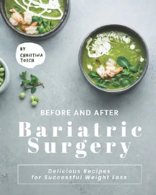 Before and After Bariatric Surgery: Delicious Recipes for Successful Weight Loss by Christina Tosch