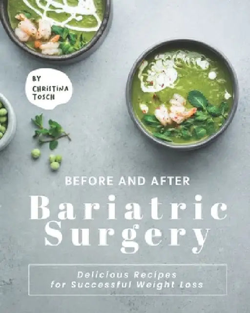 Before and After Bariatric Surgery: Delicious Recipes for Successful Weight Loss by Christina Tosch