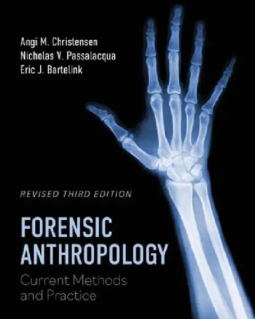 Forensic Anthropology: Current Methods and Practice by Angi M. Christensen