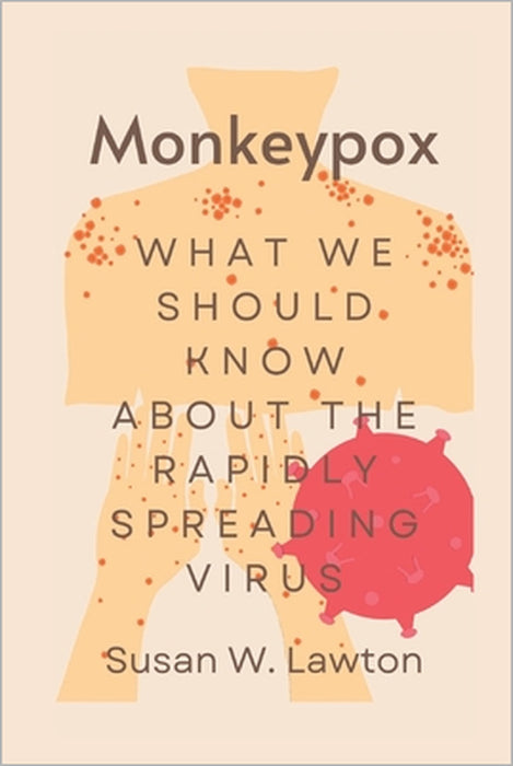 Monkeypox: What we should know about the rapidly spreading virus by Susan W. Lawton