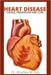 Heart disease: Causes, prevention and cure by Bradley M. Key