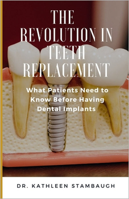 The Revolution in Teeth Replacement: What Patients Need to Know Before Having Dental Implants by Kathleen Stambaugh
