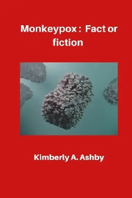 Monkeypox: Fact or Fiction by Kimberly A. Ashby