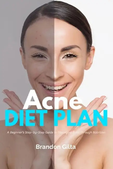 Acne Diet Plan: A Beginner's Step-by-Step Guide to Managing Acne Through Nutrition With Curated Recipes and a Sample Meal Plan by Brandon Gilta