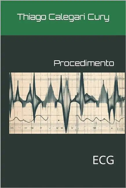 Procedimento: ECG by Cury, Camillo Gilberto