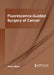 Fluorescence-Guided Surgery of Cancer by Jaime Allison