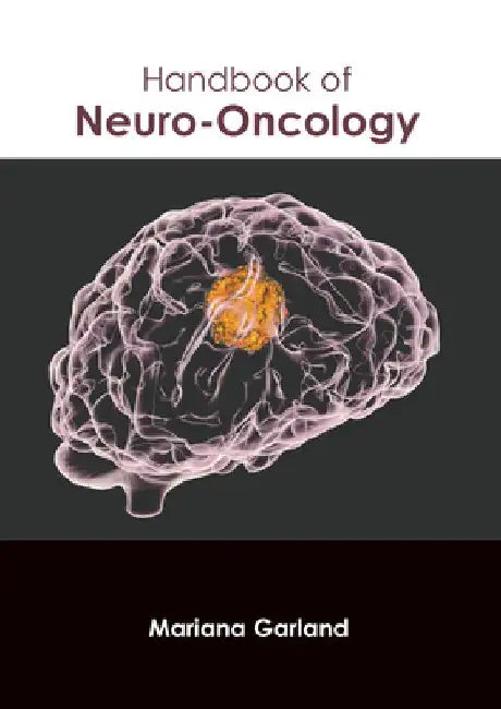 Handbook of Neuro-Oncology by Mariana Garland