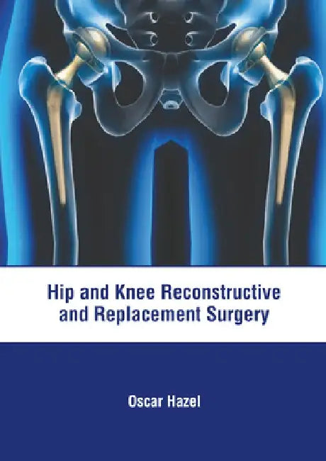 Hip and Knee Reconstructive and Replacement Surgery by Oscar Hazel