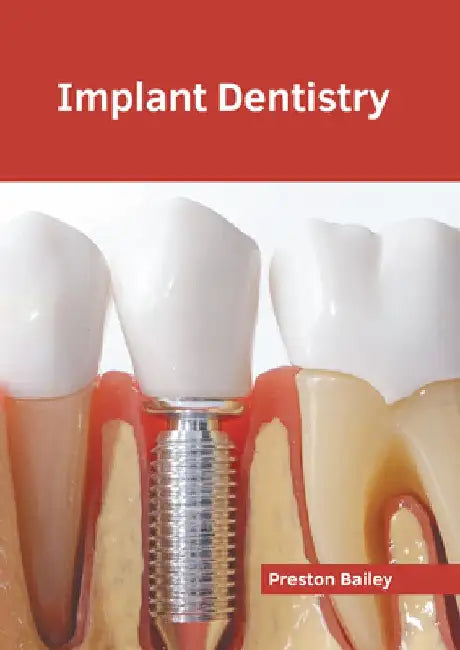 Implant Dentistry by Preston Bailey