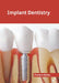 Implant Dentistry by Preston Bailey