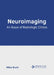 Neuroimaging: An Issue of Radiologic Clinics by Miles Scott