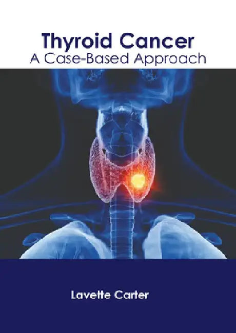 Thyroid Cancer: A Case-Based Approach by Lavette Carter
